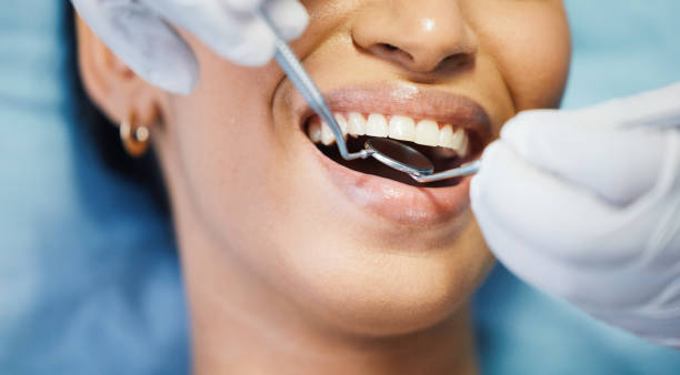 Best Weekend Emergency Dentist in Anza, CA