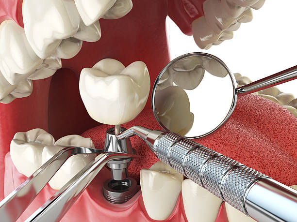 Best Walk-In Emergency Dentist in Anza, CA
